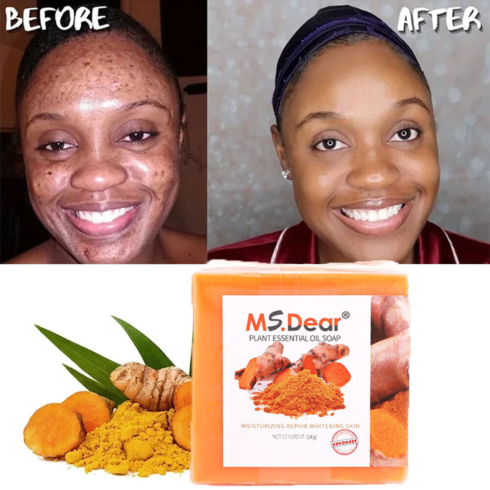 1-5 Tumeric Soap Skin Whitening Dark Spots Lightening Acne Brightening Turmeric