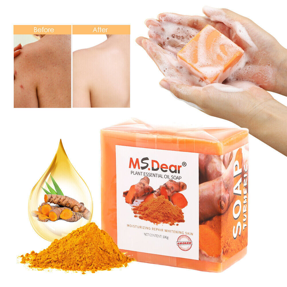 1-5 Tumeric Soap Skin Whitening Dark Spots Lightening Acne Brightening Turmeric