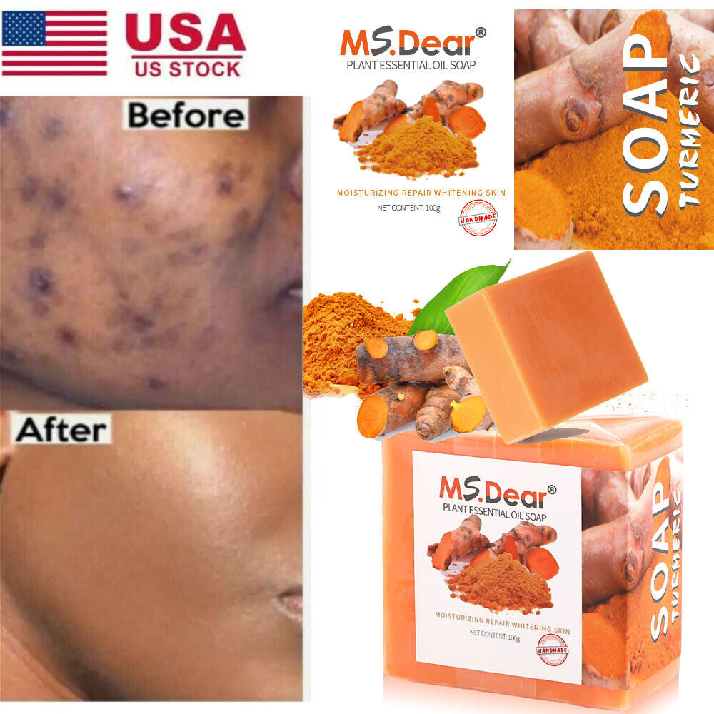 1-5 Tumeric Soap Skin Whitening Dark Spots Lightening Acne Brightening Turmeric