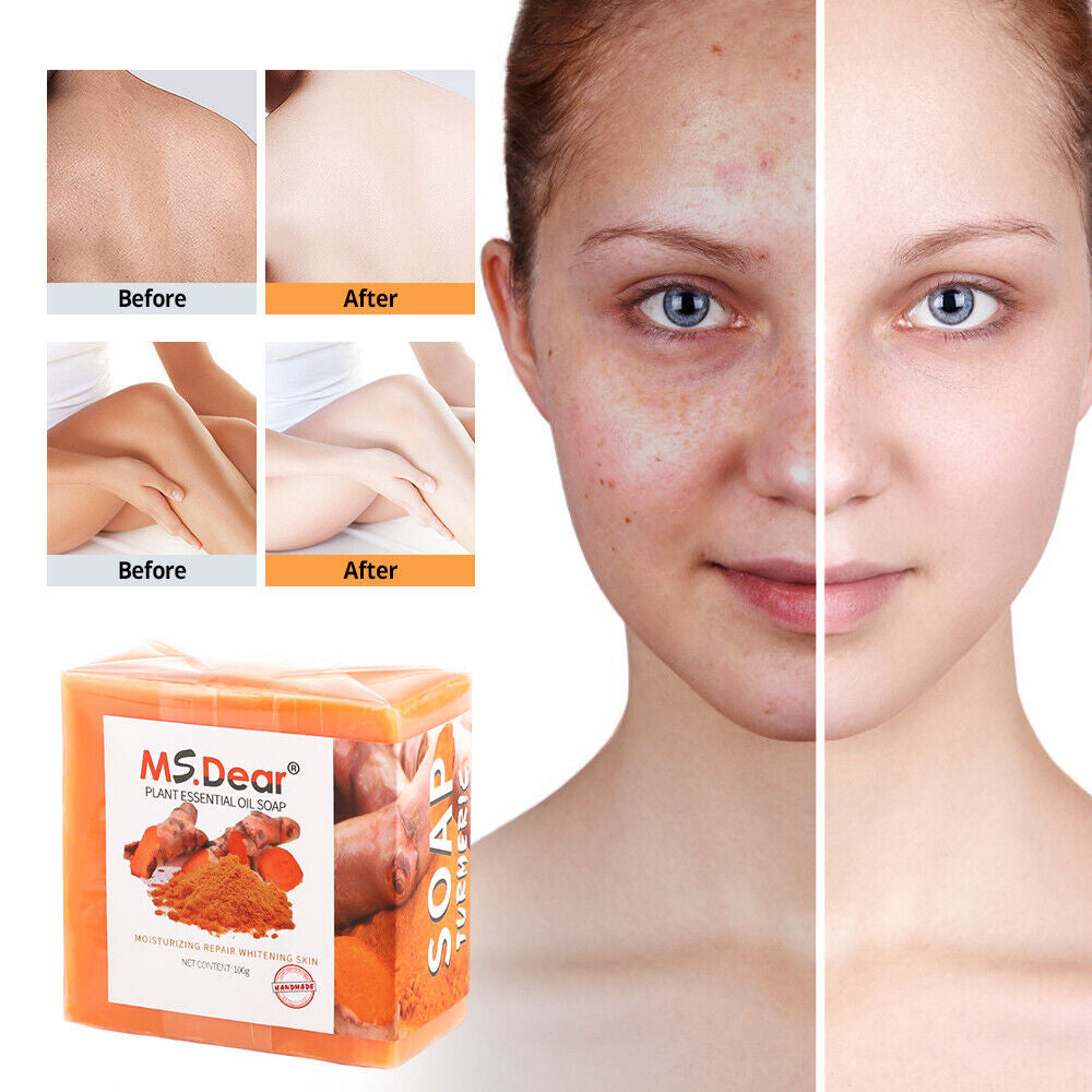 1-5 Tumeric Soap Skin Whitening Dark Spots Lightening Acne Brightening Turmeric