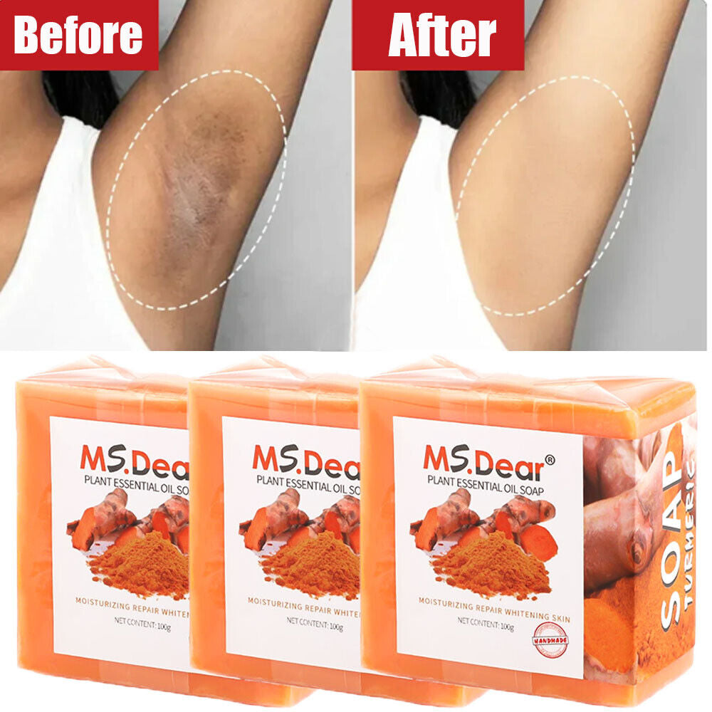 1-5 Tumeric Soap Skin Whitening Dark Spots Lightening Acne Brightening Turmeric